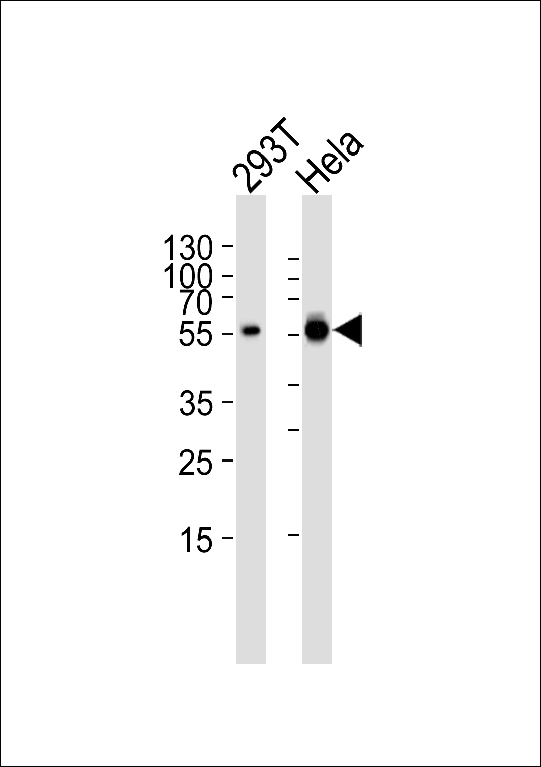 ARG55696 anti-Glutaminase antibody WB image Western blot: 35 µg of 293T, HeLa cell line (from left to right) stained with ARG55696 anti-Glutaminase antibody at 1:1000 dilution.