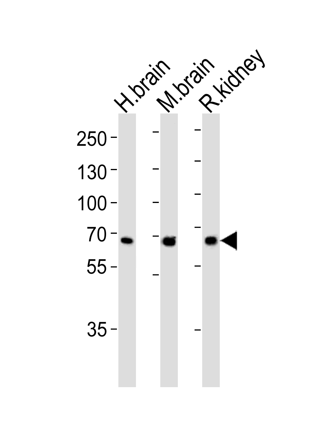 ARG55696 anti-Glutaminase antibody WB image Western blot: 35 µg of Human brain, Mouse brain ad Rat kidney tissue lysate (from left to right) stained with ARG55696 anti-Glutaminase antibody at 1:1000 dilution.