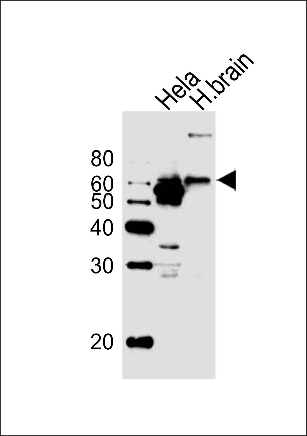 ARG55696 anti-Glutaminase antibody WB image Western blot: 20 µg of Human brain tissue and HeLa cell line (from left to right) stained with ARG55696 anti-Glutaminase antibody at 1:1000 dilution.