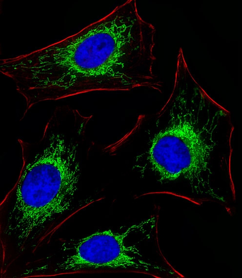 ARG55696 anti-Glutaminase antibody ICC/IF image Immunofluorescence: HeLa cells stained with ARG55696 anti-Glutaminase antibody (green) at 1:25 dilution. DAPI was used to stain the cell nuclear (blue). Cytoplasmic actin was counterstained with Alexa Fluor® 555 conjugated with Phalloidin (red).