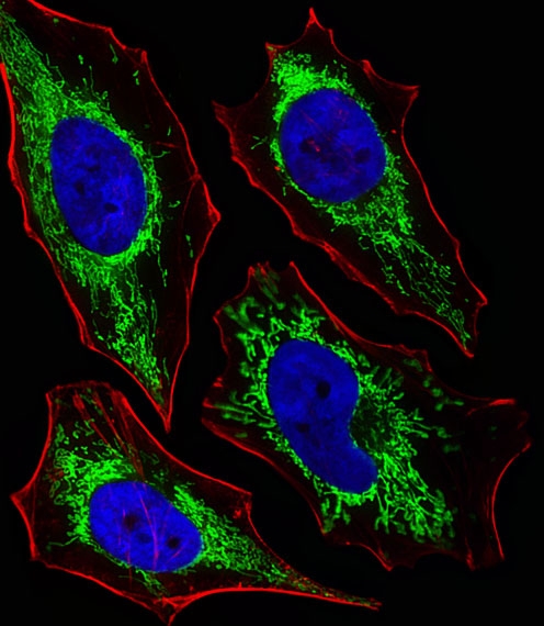 ARG55696 anti-Glutaminase antibody ICC/IF image Immunofluorescence: HeLa cells stained with ARG55696 anti-Glutaminase antibody (green) at 1:25 dilution. DAPI was used to stain the cell nuclear (blue). Cytoplasmic actin was counterstained with Alexa Fluor® 555 conjugated with Phalloidin (red).