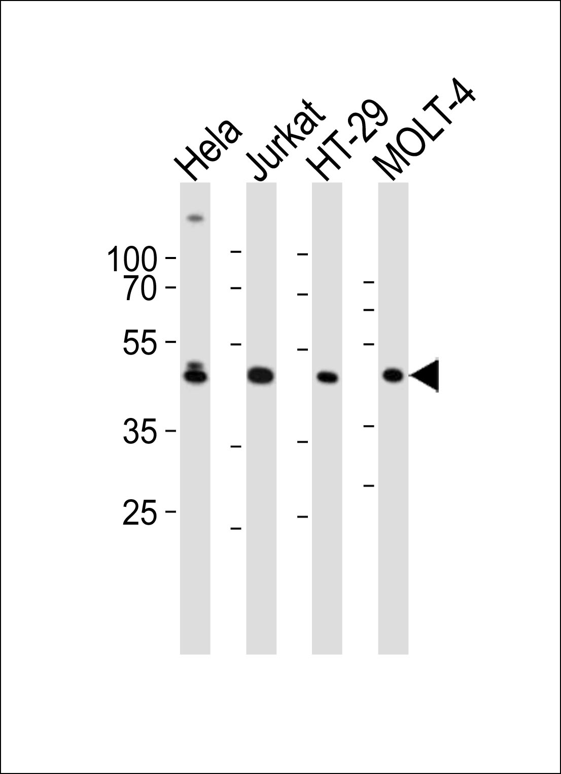 ARG55691 anti-Glutamine Synthetase antibody WB image Western blot: 20 µg of HeLa, Jurkat, HT-29, MOLT-4 cell line (from left to right) stained with ARG55691 anti-Glutamine Synthetase antibody at 1:1000 dilution.