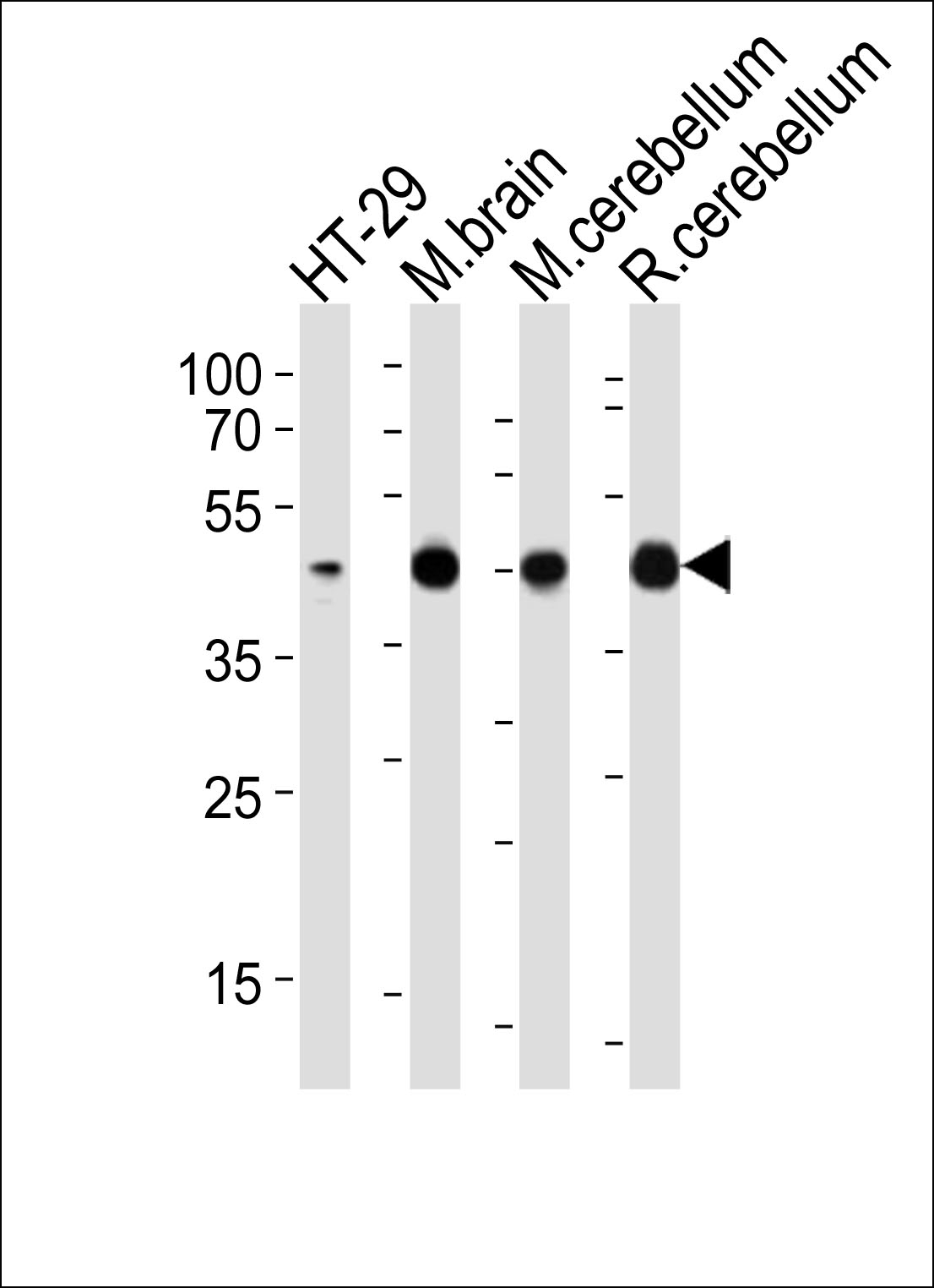 ARG55691 anti-Glutamine Synthetase antibody WB image Western blot: 20 µg of HT-29 cell line, Mouse brain, Mouse cerebellum, Rat cerebellum tissue lysate(from left to right) stained with ARG55691 anti-Glutamine Synthetase antibody at 1:2000 dilution.