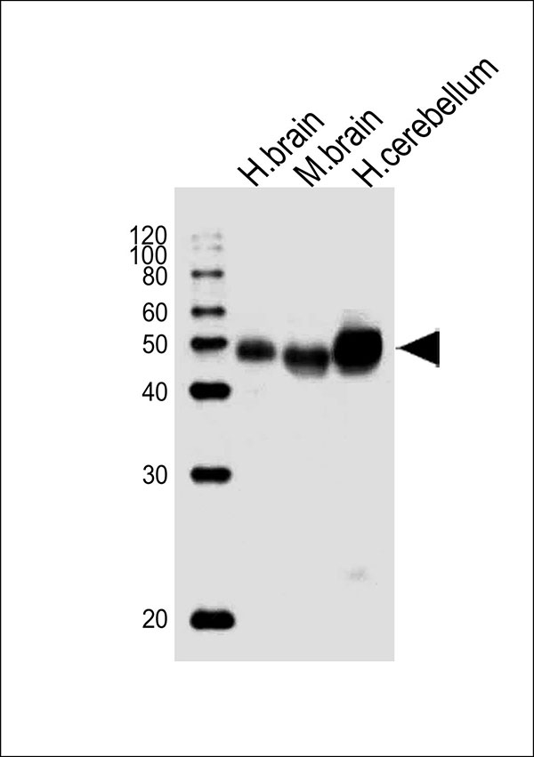 ARG55557 anti-Na+/K+ ATPase beta 2 antibody WB image Western blot: Human brain, Mouse brain, and Human cerebellum tissue lysates (from left to right) stained with ARG55557 anti-Na+/K+ ATPase beta 2 antibody at 1:1000 dilution.