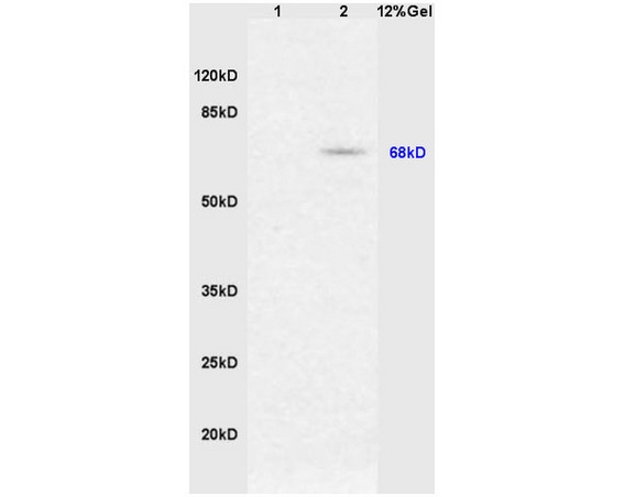 ARG55896 anti-Nrf2 phospho (Ser40) antibody WB image Western blot: 1) Mouse heart, 2) Mouse muscle lysates stained with ARG55896 anti-Nrf2 phospho (Ser40) antibody at 1:200 dilution (4˚C).