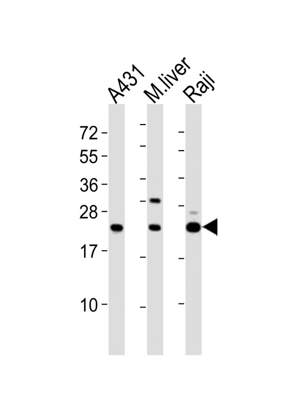 ARG55778 anti-Proteasome 20S LMP2 antibody WB image Western blot: 20 µg of 1) A431 whole cell lysates, 2) mouse liver lysates, 3) Raji whole cell lysates stained with ARG55778 anti-Proteasome 20S LMP2 antibody at 1:2000 dilution.