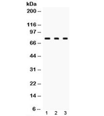 ARG10593 anti-TGM2 antibody WB image Western blot: 1) Rat liver, 2) Rat ovary, and 3) HeLa cell lysate stained with ARG10593 anti-TGM2 antibody.