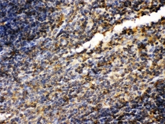 ARG10593 anti-TGM2 antibody IHC-P image Immunohistochemistry: Mouse spleen tissue stained with ARG10593 anti-TGM2 antibody.