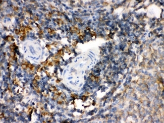 ARG10593 anti-TGM2 antibody IHC-P image Immunohistochemistry: Rat spleen tissue stained with ARG10593 anti-TGM2 antibody.