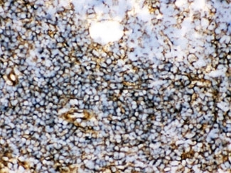 ARG10593 anti-TGM2 antibody IHC-Fr image Immunohistochemistry: Rat spleen tissue stained with ARG10593 anti-TGM2 antibody.