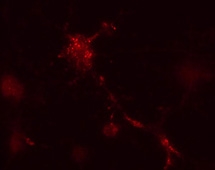 ARG54815 anti-ATG12 antibody ICC/IF image Immunofluorescence: Mouse leukaemic monocyte macrophage cells treated with vinblastine for 1 hr. ARG54815 anti-ATG12 antibody detected punctuate staining indicative of nascent autophagic vacuole structures. Data courtesy of Dr. Barry Boland, Department of Pharmacology, Oxford University.