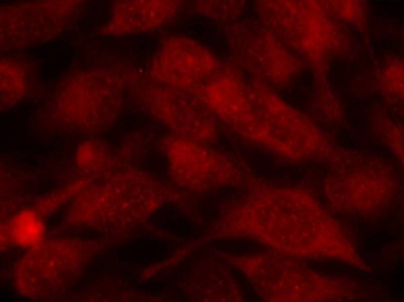 ARG51198 anti-Stathmin 1 antibody ICC/IF image Immunofluorescence: methanol-fixed HeLa cells stained with anti-Stathmin 1 antibody ARG51198.