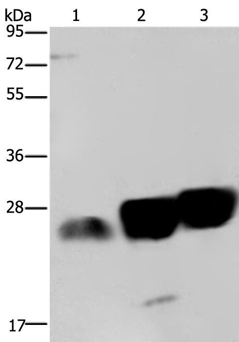 ARG65578 anti-NDUFS8 Antibody WB image Western Blot: ARG65578 NDUFS8 Antibody at 1/250 dilution with 40 μg of lysates. (1) Jurkat cell (2) Mouse heart tissue (3) Mouse brain tissue Exposure time: 20 seconds.