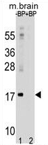 ARG54709 anti-LC3A antibody WB image Western blot: 35 μg of mouse brain tissue lysates stained with ARG54709 anti-LC3A antibody.