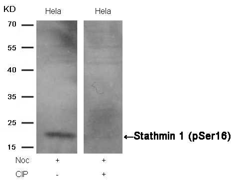 ARG51724 anti-Stathmin 1 phospho (Ser16) antibody WB image Western Blot: extracts from HeLa cells, treated with Noc or calf intestinal phosphatase (CIP), stained with anti-Stathmin 1 (phospho Ser16) antibody ARG51724.