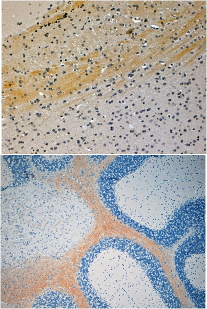ARG63322 anti-JIP3 / Syd2 / JSAP1 antibody IHC-P image Immunohistochemistry: paraffin embedded Mouse Brain. (Steamed antigen retrieval with citrate buffer pH 6) stained with ARG63322 anti-JIP3 / Syd2 / JSAP1 antibody at 4 µg/ml dilution followed by HRP-staining.
