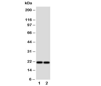 Western blot testing of Surfactant Protein C antibody and Lane 1:  A549;  2: HeLa cell lysate.  Expected/observed size ~21KD