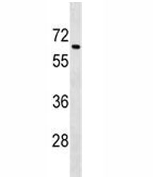 Tgfbr2 antibody western blot analysis in mouse spleen tissue lysate. Expected molecular weight ~65 kDa, routinely observed at 65-80 kDa.