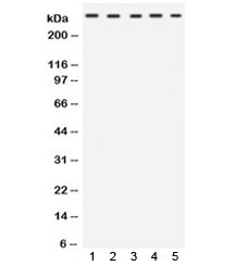 Western blot testing of 1) rat heart, 2) rat skeletal muscle, 3) mouse heart, 4) mouse skeletal muscle and 5) human HeLa lysate with TRIO antibody. Expected molecular weight ~347 kDa.
