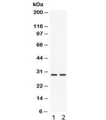 Western blot testing of 1) mouse liver and 2) mouse kidney lysate with Cathepsin G antibody. Predicted molecular weight ~29 kDa, can be observed at ~36 kDa.