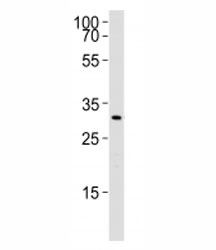 Western blot analysis of lysate from rat liver using Cebpb antibody. Ab was diluted at 1:1000. Predicted molecular weight: ~33/33/36kDa (rat/mouse/human).