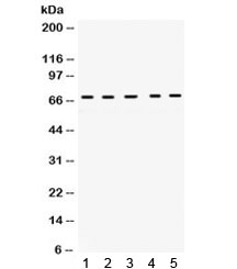 Western blot testing of 1) rat liver, 2) rat skeletal muscle, 3) rat spleen, 4) human SKOV and 5) human A431 lysate with Cytokeratin 1 antibody. Expected/observed molecular weight ~67 kDa.