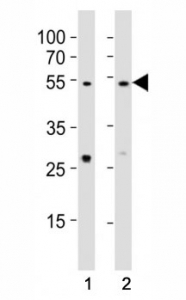 Western blot testing of EED antibody at 1:1000 dilution. Lane 1: A431 lysate; 2: NIH3T3 lysate; Predicted molecular weight: 50 kDa (isoform 1), 53 kDa (isoform 2), 46 kDa (isoform 3).