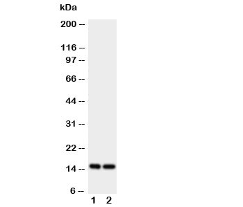 Western blot testing of FABP5 antibody and Lane 1:  rat liver;  2: rat kidney tissue lysate