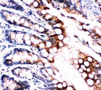 IHC-P: FABP5 antibody testing of rat intestine tissue