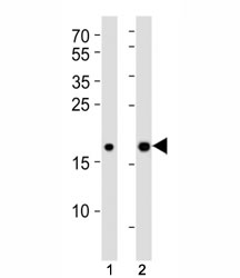 Western blot analysis of lysate from (1) human HepG2 and (2) mouse NIH3T3 cell lines using Hmga2 antibody at 1:1000. Predicted molecular weight ~12kDa but routinely observed at ~18kDa.