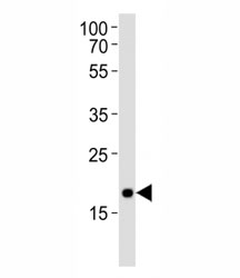 Western blot analysis of lysate from NCCIT cell line using Hmga2 antibody at 1:1000. Predicted molecular weight ~12kDa but routinely observed at ~18kDa.
