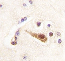 IHC analysis of FFPE human brain tissue stained with Lhx6 antibody