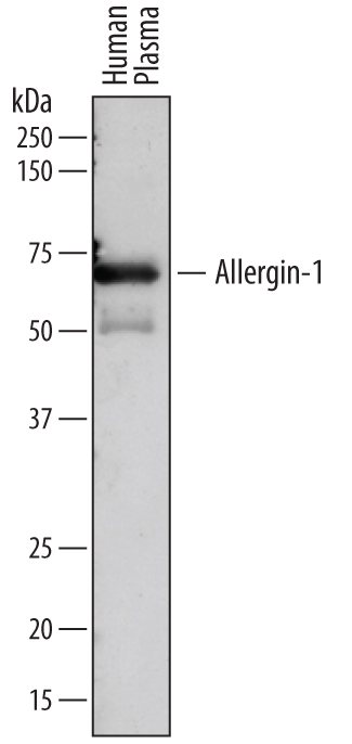 Detection of Human Allergin-1 by Western Blot. Western blot shows human plasma. PVDF membrane was probed with 0.5 µg/mL of Sheep Anti-Human Allergin-1 Antigen Affinity-purified Polyclonal Antibody (Catalog # AF7364) followed by HRP-conjugated Anti-Sheep IgG Secondary Antibody (Catalog # HAF016). A specific band was detected for Allergin-1 at approximately 70 kDa (as indicated). This experiment was conducted under reducing conditions and using Immunoblot Buffer Group 1.