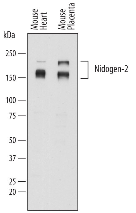 Detection of Mouse Nidogen‑2 by Western Blot. Western blot shows lysates of mouse heart tissue and mouse placenta tissue. PVDF membrane was probed with 0.2 µg/mL of Sheep Anti-Mouse Nidogen‑2 Antigen Affinity-purified Polyclonal Antibody (Catalog # AF6760) followed by HRP-conjugated Anti-Sheep IgG Secondary Antibody (Catalog # HAF016). Specific bands were detected for Nidogen‑2 at approximately 160-200 kDa (as indicated). This experiment was conducted under reducing conditions and using Immunoblot Buffer Group 1.