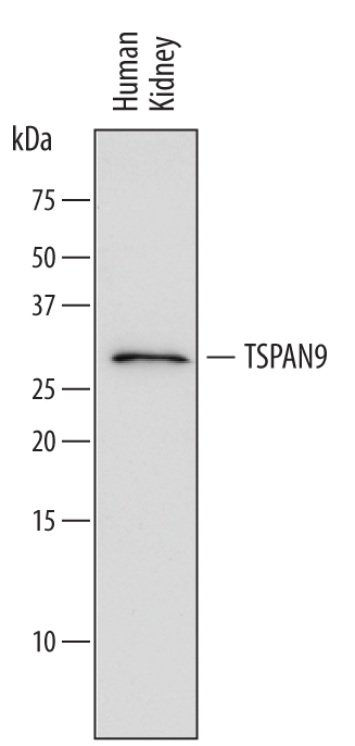 Detection of Human TSPAN9 by Western Blot. Western blot shows lysates of human kidney tissue. PVDF membrane was probed with 1 µg/mL of Mouse Anti-Human TSPAN9 Monoclonal Antibody (Catalog # MAB6565) followed by HRP-conjugated Anti-Mouse IgG Secondary Antibody (Catalog # HAF018). A specific band was detected for TSPAN9 at approximately 27 to 30 kDa (as indicated). This experiment was conducted under reducing conditions and using Immunoblot Buffer Group 1.