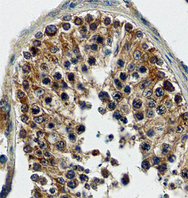 FABP9/T‑FABP in Human Testis. FABP9/T‑FABP was detected in immersion fixed paraffin-embedded sections of human testis using Human FABP9/T‑FABP Antigen Affinity-purified Polyclonal Antibody (Catalog # AF5707) at 10 µg/mL overnight at 4 °C. Before incubation with the primary antibody, tissue was subjected to heat-induced epitope retrieval using Antigen Retrieval Reagent-Basic (Catalog # CTS013). Tissue was stained using the Anti-Sheep HRP-DAB Cell & Tissue Staining Kit (brown; Catalog # CTS019) and counterstained with hematoxylin (blue). Specific staining was localized to the plasma membrane and cytoplasm of spermatocytes. View our protocol for Chromogenic IHC Staining of Paraffin-embedded Tissue Sections.