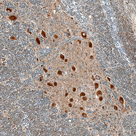 LRRC3 in Human Brain. LRRC3 was detected in immersion fixed paraffin-embedded sections of human brain (medulla) using Sheep Anti-Human LRRC3 Antigen Affinity‑purified Polyclonal Antibody (Catalog # AF5039) at 10 µg/mL overnight at 4 °C. Before incubation with the primary antibody, tissue was subjected to heat-induced epitope retrieval using Antigen Retrieval Reagent‑Basic (Catalog # CTS013). Tissue was stained using the Anti-Sheep HRP-DAB Cell & Tissue Staining Kit (brown; Catalog # CTS019) and counter­stained with hematoxylin (blue). Specific staining was localized to neuronal cell bodies. View our protocol for Chromogenic IHC Staining of Paraffin-embedded Tissue Sections.