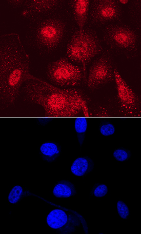 PDZD2 in PC‑3 Human Cell Line. PDZD2 was detected in immersion fixed PC‑3 human prostate cancer cell line using Mouse Anti-Human PDZD2 Monoclonal Antibody (Catalog # MAB7670) at 10 µg/mL for 3 hours at room temperature. Cells were stained using the NorthernLights™ 557-conjugated Anti-Mouse IgG Secondary Antibody (red, upper panel; Catalog # NL007) and counterstained with DAPI (blue, lower panel). Specific staining was localized to nuclei and cytoplasm. View our protocol for Fluorescent ICC Staining of Cells on Coverslips.