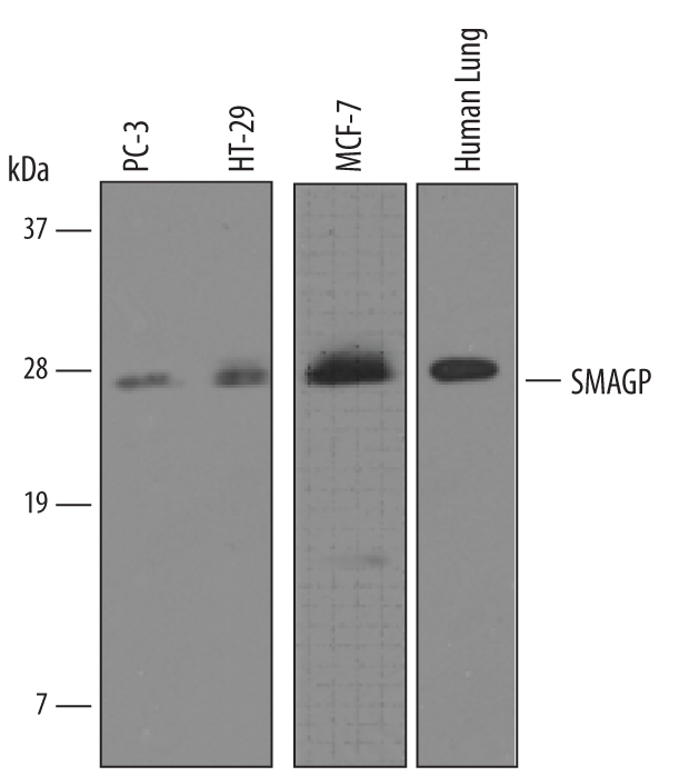 Detection of Human SMAGP by Western Blot. Western blot shows lysates of human lung tissue, PC‑3 human prostate cancer cell line, HT‑29 human colon adenocarcinoma cell line, and MCF‑7 human breast cancer cell line. PVDF membrane was probed with 1 µg/mL of Goat Anti-Human SMAGP Antigen Affinity-purified Polyclonal Antibody (Catalog # AF3959) followed by HRP-conjugated Anti-Goat IgG Secondary Antibody (Catalog # HAF019). A specific band was detected for SMAGP at approximately 26 kDa (as indicated). This experiment was conducted under reducing conditions and using Immunoblot Buffer Group 8. 