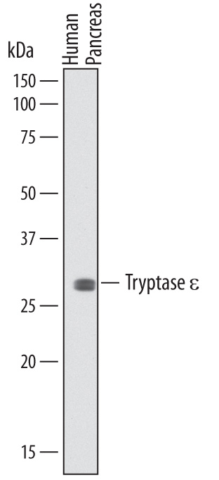 Detection of Human Tryptase  epsilon/BSSP‑4 by Western Blot. Western blot shows lysates of human pancreas tissue. PVDF membrane was probed with 2 µg/mL of Mouse Anti-Human Tryptase  epsilon/BSSP‑4 Monoclonal Antibody (Catalog # MAB5047) followed by HRP-conjugated Anti-Mouse IgG Secondary Antibody (Catalog # HAF007). A specific band was detected for Tryptase  epsilon/BSSP‑4 at approximately 34 kDa (as indicated). This experiment was conducted under reducing conditions and using Immunoblot Buffer Group 8. 