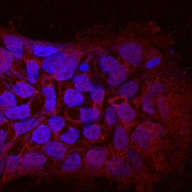 WTX in BG01V Human Embryonic Stem Cells. WTX was detected in immersion fixed BG01V human embryonic stem cells using Mouse Anti-Human WTX Monoclonal Antibody (Catalog # MAB7374) at 10 µg/mL for 3 hours at room temperature. Cells were stained using the NorthernLights™ 557-conjugated Anti-Mouse IgG Secondary Antibody (red; Catalog # NL007) and counterstained with DAPI (blue). Specific staining was localized to cytoplasm. View our protocol for Fluorescent ICC Staining of Cells on Coverslips.