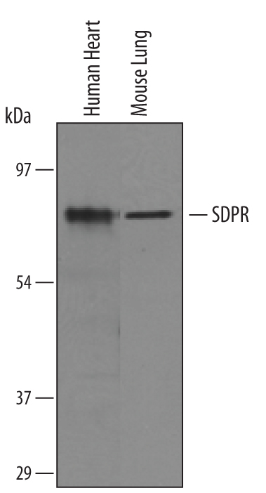 Detection of Human and Mouse SDPR by Western Blot. Western blot shows lysates of human heart and mouse lung tissue. PVDF membrane was probed with 1 µg/mL of Goat Anti-Human/Mouse SDPR Antigen Affinity-purified Polyclonal Antibody (Catalog # AF5759) followed by HRP-conjugated Anti-Goat IgG Secondary Antibody (Catalog # HAF019). A specific band was detected for SDPR at approximately 70 kDa (as indicated). This experiment was conducted under reducing conditions and using Immunoblot Buffer Group 8.