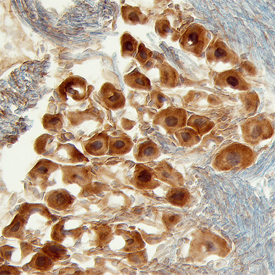 Heparan Sulfate 6-O-Sulfotransferase 3/HS6ST3 in Mouse Brain . Heparan Sulfate 6-O-Sulfotransferase 3/HS6ST3 was detected in perfusion fixed frozen sections of mouse brain (trigeminal ganglion) using Sheep Anti-Mouse Heparan Sulfate 6-O-Sulfotransferase 3/HS6ST3 Antigen Affinity-purified Polyclonal Antibody (Catalog # AF5406) at 5 µg/mL overnight at 4 °C. Tissue was stained using the Anti-Sheep HRP-DAB Cell & Tissue Staining Kit (brown; Catalog # CTS019) and counterstained with hematoxylin (blue). Specific staining was localized to neuronal cell bodies. View our protocol for Chromogenic IHC Staining of Frozen Tissue Sections.
