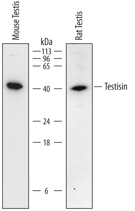 Detection of Mouse and Rat Testisin/Prss21 by Western Blot. Western blot shows lysates of mouse testis tissue and rat testis tissue. PVDF membrane was probed with 0.5 µg/mL of Goat Anti-Mouse Testisin/Prss21 Antigen Affinity-purified Polyclonal Antibody (Catalog # AF6820) followed by HRP-conjugated Anti-Goat IgG Secondary Antibody (Catalog # HAF017). A specific band was detected for Testisin/Prss21 at approximately 40 kDa (as indicated). This experiment was conducted under reducing conditions and using Immunoblot Buffer Group 1. 