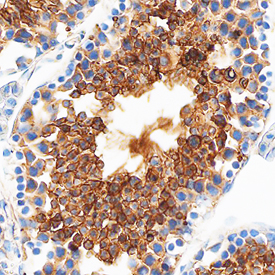 Testisin/Prss21 in Mouse Testis. Testisin/Prss21 was detected in perfusion fixed frozen sections of mouse testis using Goat Anti-Mouse Testisin/Prss21 Antigen Affinity-purified Polyclonal Antibody (Catalog # AF6820) at 1.7 µg/mL overnight at 4 °C. Tissue was stained using the Anti-Goat HRP-DAB Cell & Tissue Staining Kit (brown; Catalog # CTS008) and counterstained with hematoxylin (blue). Specific staining was localized to the plasma membranes of spermatocytes. View our protocol for Chromogenic IHC Staining of Frozen Tissue Sections. This application has not been tested in rat samples.