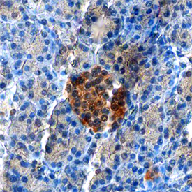 ZnT‑8 in Human Pancreas. ZnT‑8 was detected in immersion fixed paraffin-embedded sections of human pancreas using Mouse Anti-Human ZnT‑8 Monoclonal Antibody (Catalog # MAB7936) at 15 µg/mL overnight at 4 °C. Before incubation with the primary antibody, tissue was subjected to heat-induced epitope retrieval using Antigen Retrieval Reagent-Basic (Catalog # CTS013). Tissue was stained using the Anti-Mouse HRP-DAB Cell & Tissue Staining Kit (brown; Catalog # CTS002) and counterstained with hematoxylin (blue). Specific staining was localized to cytoplasm of islet cells. View our protocol for Chromogenic IHC Staining of Paraffin-embedded Tissue Sections.