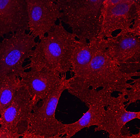 CLEC14A in HUVEC Human Cells. CLEC14A was detected in immersion fixed HUVEC human umbilical vein endothelial cells using Sheep Anti-Human CLEC14A Antigen Affinity-purified Polyclonal Antibody (Catalog # AF4968) at 10 µg/mL for 3 hours at room temperature. Cells were stained using the NorthernLights™ 557-conjugated Anti-Sheep IgG Secondary Antibody (red; Catalog # NL010 ) and counterstained with DAPI (blue). Specific staining was localized to cell surfaces and cytoplasm. View our protocol for Fluorescent ICC Staining of Cells on Coverslips .