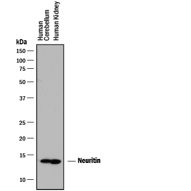 Detection of Human Neuritin by Western Blot. Western blot shows lysates of human brain (cerebellum) tissue and human kidney tissue. PVDF membrane was probed with 1 µg/mL of Goat Anti-Human/Rat Neuritin Antigen Affinity-purified Polyclonal Antibody (Catalog # AF283) followed by HRP-conjugated Anti-Goat IgG Secondary Antibody (Catalog # HAF017 ). A specific band was detected for Neuritin at approximately 14 kDa (as indicated). This experiment was conducted under reducing conditions and using Immunoblot Buffer Group 1 .