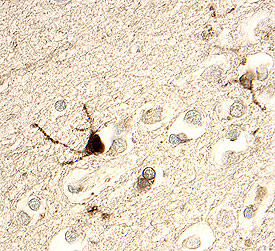Choline Acetyltransferase/ChAT in Human Brain. Choline Acetyltransferase/ChAT was detected in immersion fixed paraffin-embedded sections of human brain (cortex) using 15 µg/mL Goat Anti-Human Choline Acetyltransferase/ChAT Antigen Affinity-purified Polyclonal Antibody (Catalog # AF3447) overnight at 4 °C. Tissue was stained with the Anti-Goat HRP-DAB Cell & Tissue Staining Kit (brown; Catalog # CTS008 ) and counterstained with hematoxylin (blue). View our protocol for Chromogenic IHC Staining of Paraffin-embedded Tissue Sections .