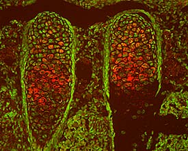 TSG in Mouse Embryo. TSG was detected in immersion fixed frozen sections of mouse embryo using 15 µg/mL Goat Anti-Mouse TSG Antigen Affinity-purified Polyclonal Antibody (Catalog # AF756) overnight at 4 °C. Tissue was stained (red) and counter­stained (green). View our protocol for Fluorescent IHC Staining of Frozen Tissue Sections .